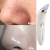 Blackhead Remover Vaccum Suction