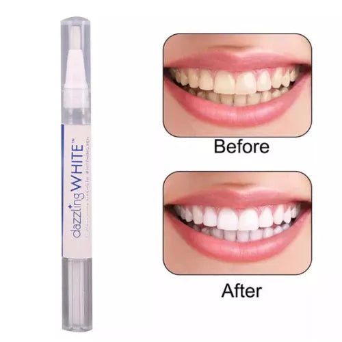 Professional Teeth Whitening & Stain Removing Pen Made in USA